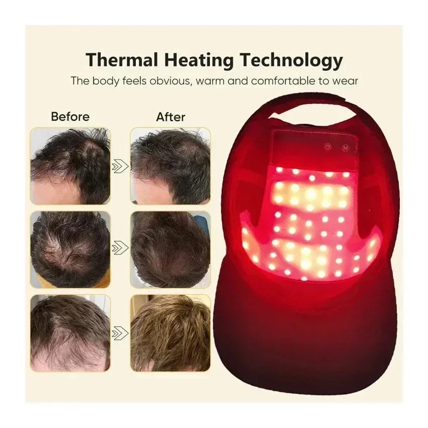 Gorra de terapia láser para Biohacking capilar, estimulación del folículo piloso y prevención de la caída del cabello en casa