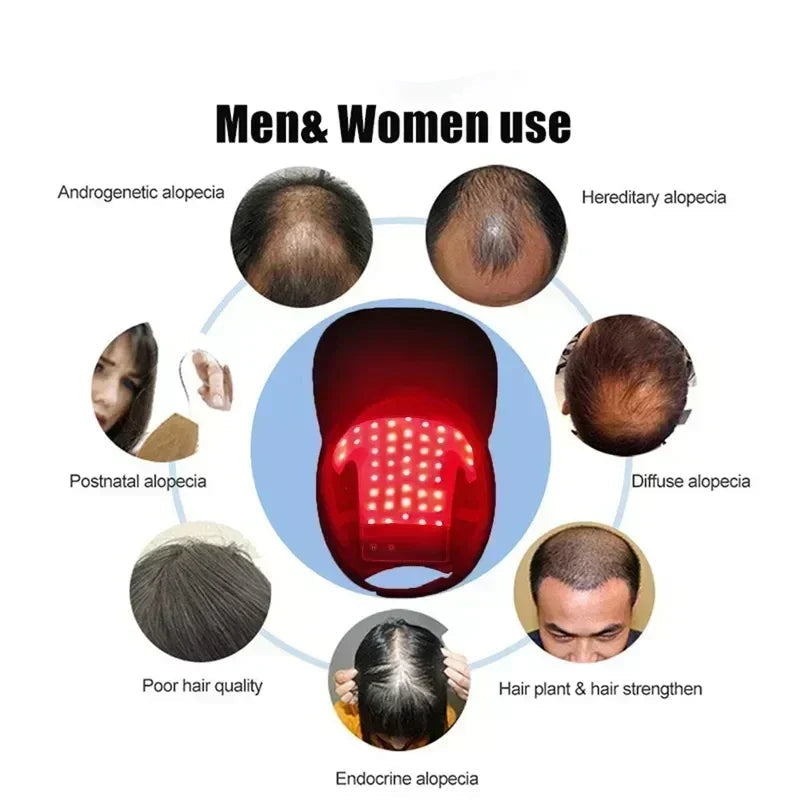 Gorra de terapia láser para Biohacking capilar, estimulación del folículo piloso y prevención de la caída del cabello en casa