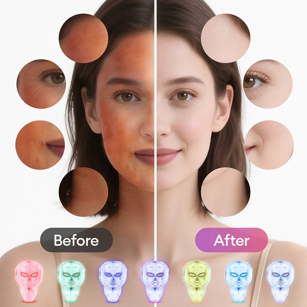 Comparativa de antes y después del tratamiento facial con máscara de luz LED y muestra de los diferentes colores de fototerapia disponibles para el cuidado de la piel